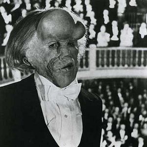 Foto El hombre elefante