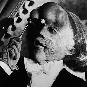 Foto El hombre elefante