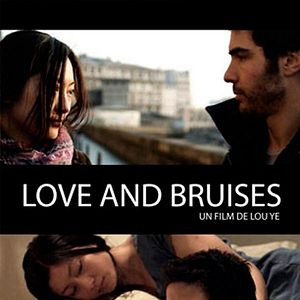 Foto Love and Bruises