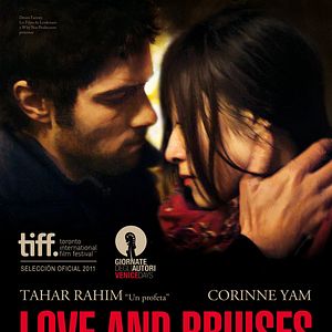 Foto Love and Bruises