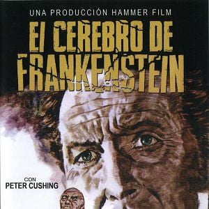 Foto El cerebro de Frankenstein