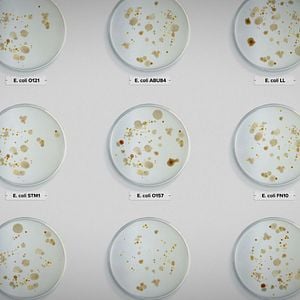 Foto Intoxicación: La cruda verdad de nuestra comida