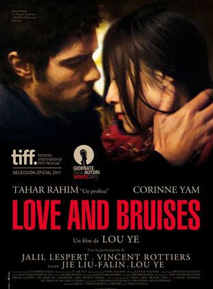  Love and Bruises
