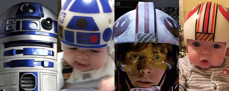 Un padre se inspira en 'Star Wars' para crear unos cascos que ayuden a su hijo con craneosinostosis noticias imagen