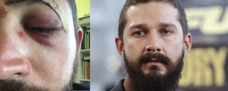Pegan a un hombre en Nueva York por parecerse a Shia LaBeouf noticias imagen