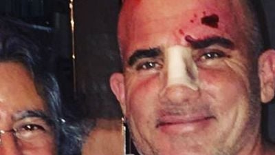 Dominic Purcell sobre su accidente en el rodaje de 'Prison Break': "Pensé que iba a morir" noticias imagen