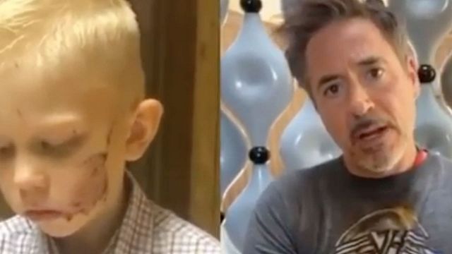 Robert Downey Jr. envía un mensaje al niño que salvó a su hermana del ataque de un perro noticias imagen