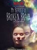 Cartel de My Beautiful Broken Brain