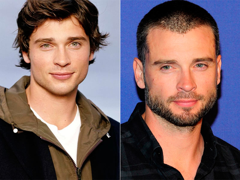 Smallville Así Han Cambiado Los Protagonistas De La Serie Clark Kent