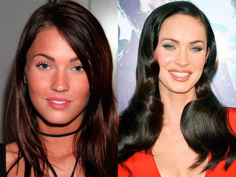 20 Actores Antes Y Después De Pasar Por Quirófano Megan Fox